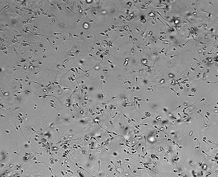 Сперма под микроскопом.jpg