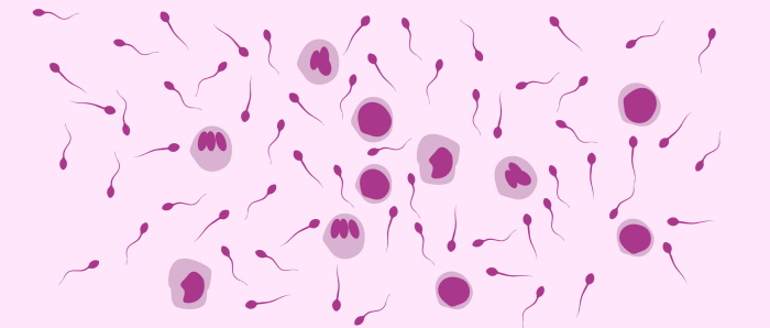 Лейкоциты в сперме.jpg