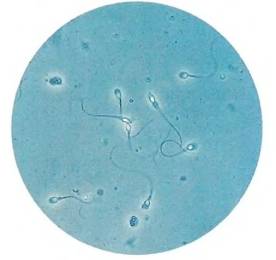 Сперматозоиды под микроскопом.jpg